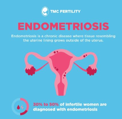 Endometriosis Awareness Month: The Complexities Behind The Life ...